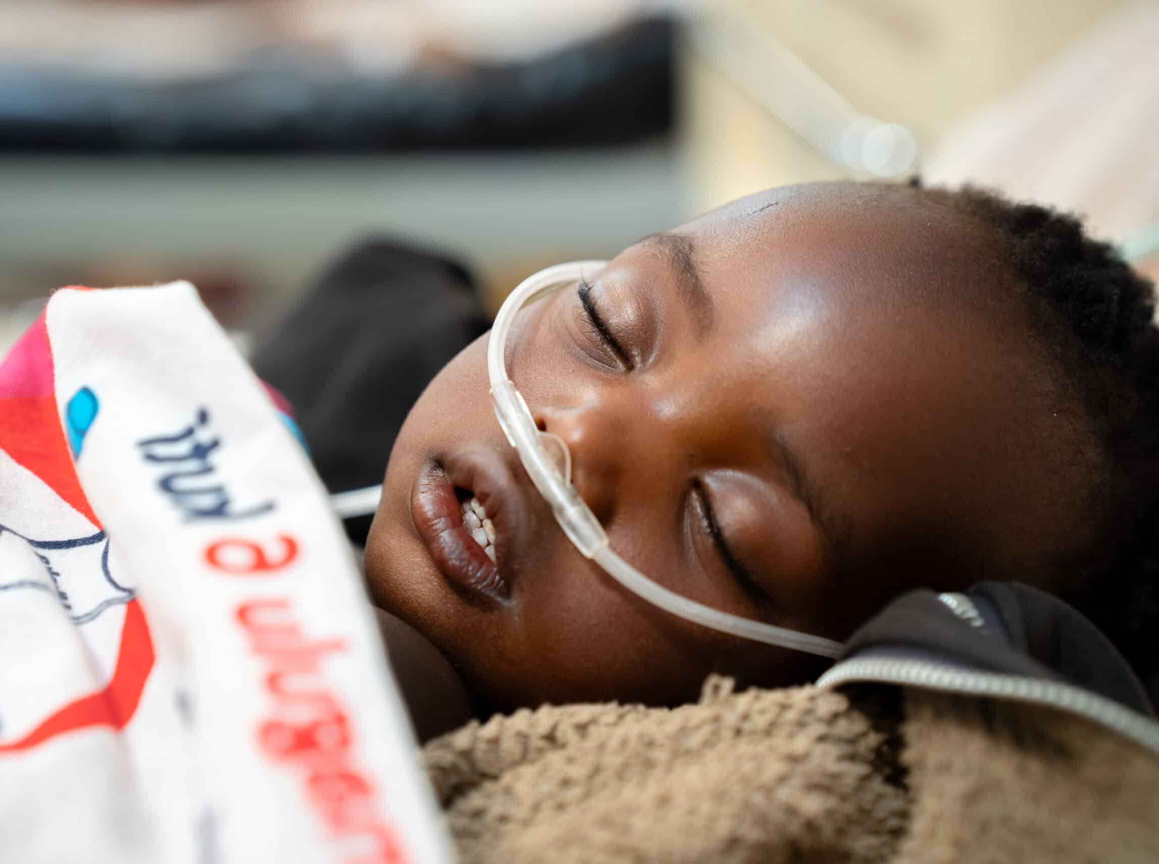 A sleeping child receiving oxygen