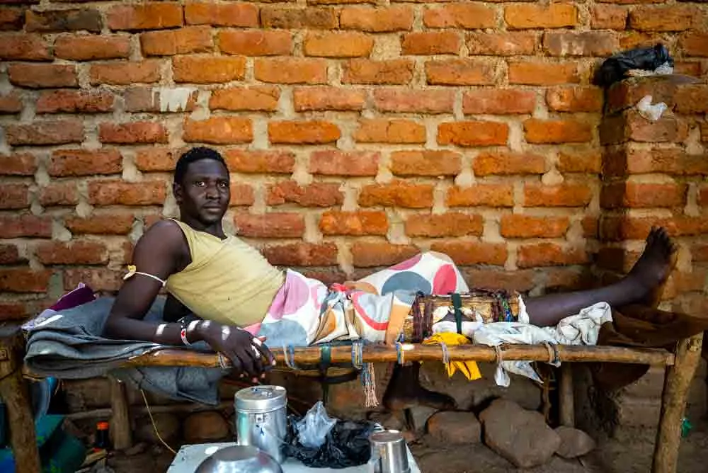 A patient with a serious leg injury rests on a bed in a rural hospital setting.