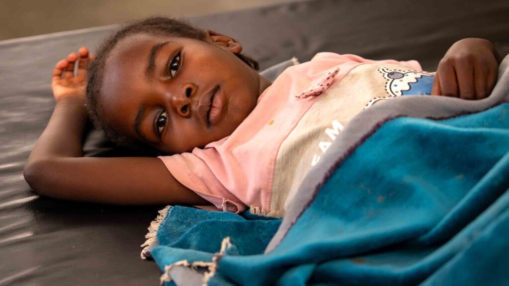 A young girl rests in a hospital bed under a blue blanket during recovery from burn injuries.