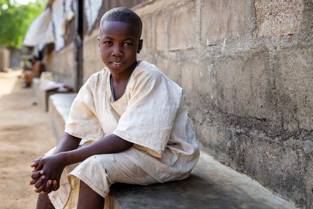 A boy sits outside the hospital during recovery after treatment for burn injuries.